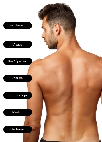Body areas compatible with laser hair removal for men