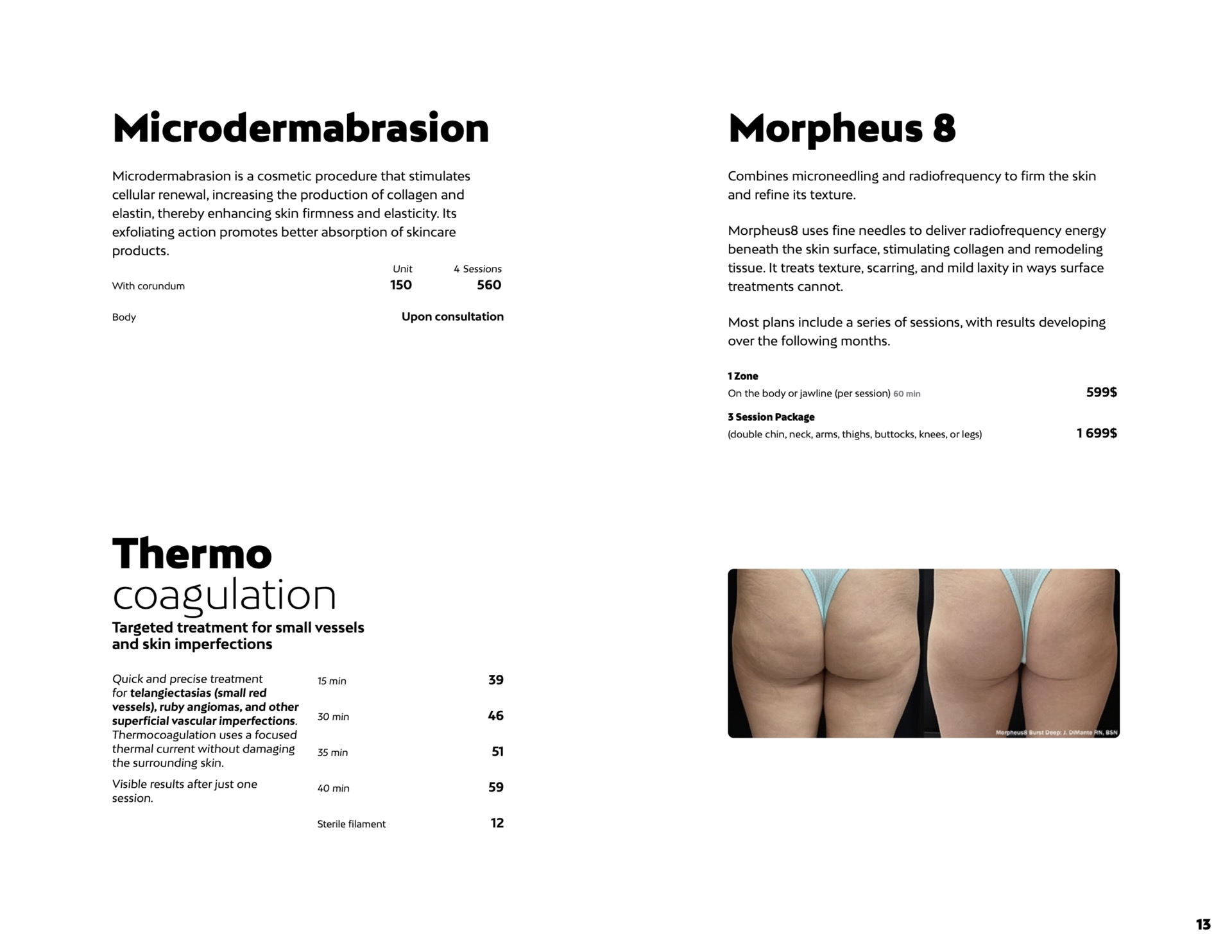 Microdermabrasion, thermocoagulation and Morpheus 8 prices at Liv Beauty & Spa