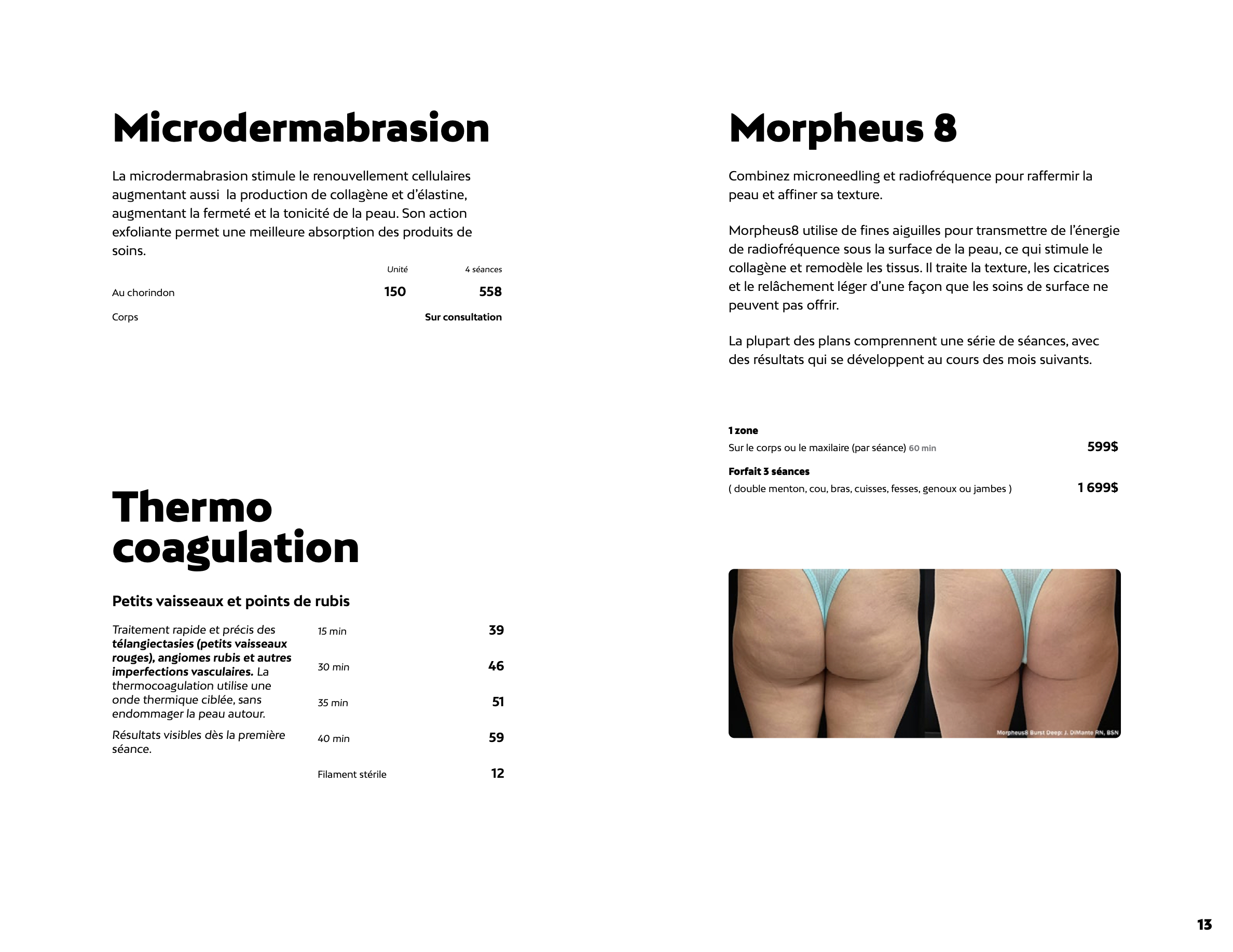 Prix de la microdermabrasion, de la thermocoagulation et du Morpheus 8 chez Liv Beauté & Spa