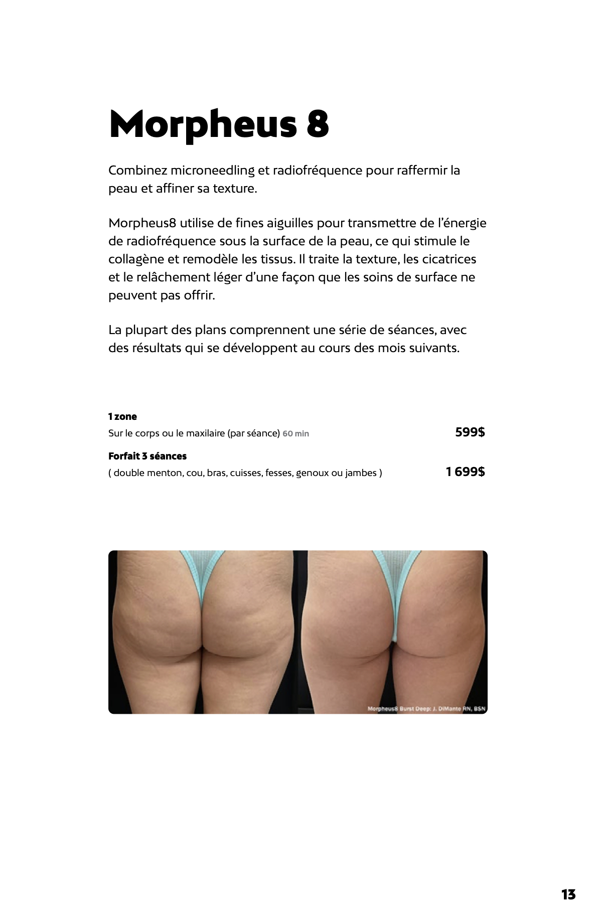 Prix du Morpheus 8 chez Liv Beauté & Spa