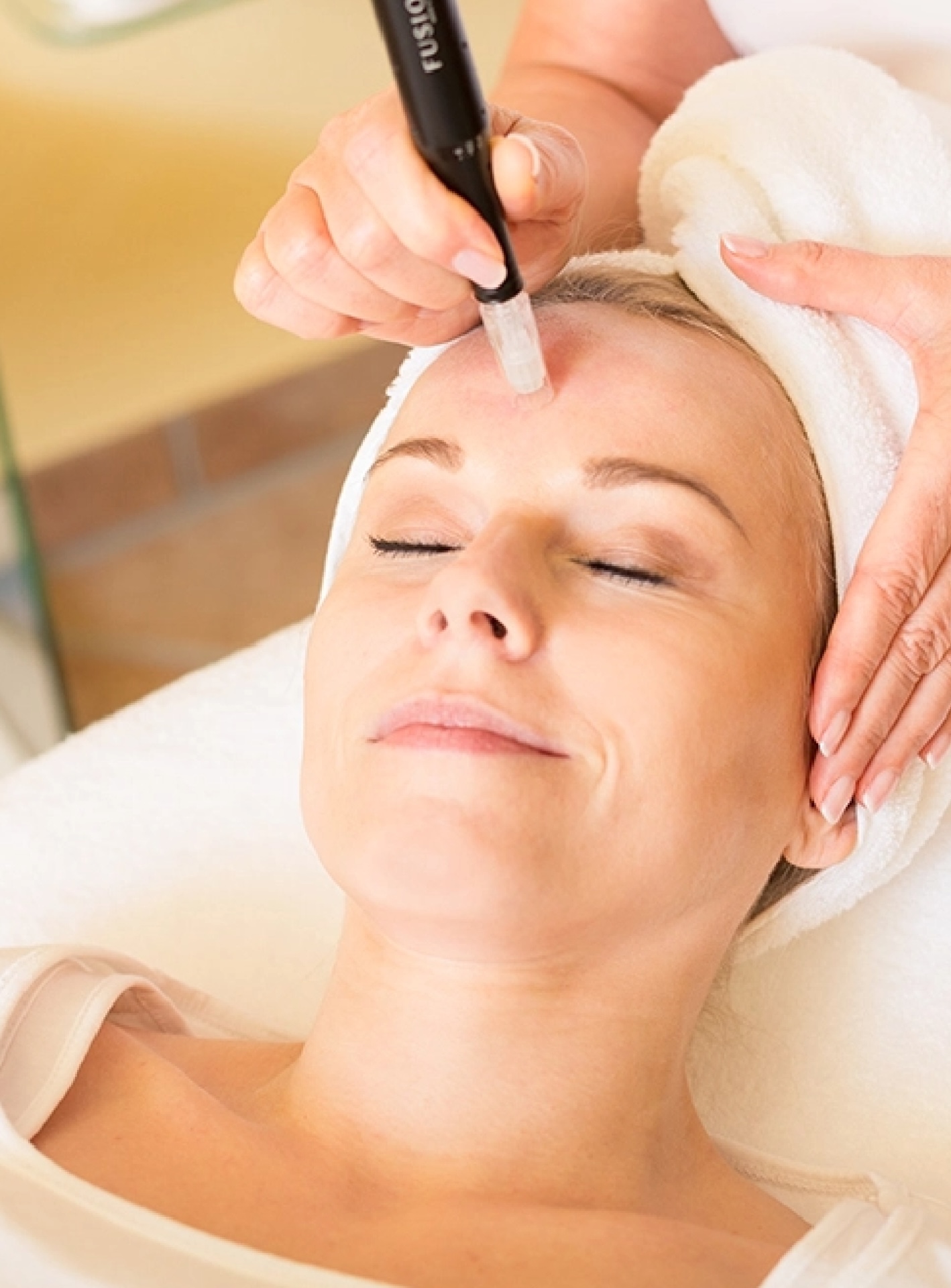 Promo micro-needling